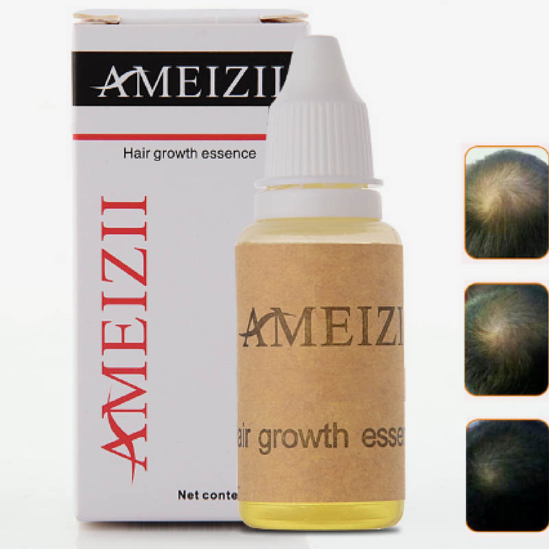 Ameizii Hair Growth Oil